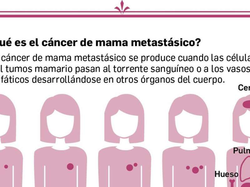 Cáncer de mama mestastásico
